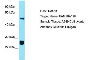 Host: Rabbit Target Name: FAM90A12P Sample Tissue: Human A549 Whole Cell Antibody Dilution: 1ug/ml (FAM90A12P 抗体  (Middle Region))