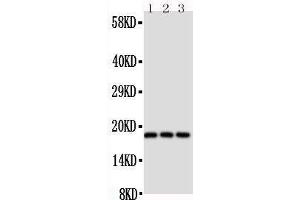 Anti-CD90/Thy1 antibody,  Western blotting Lane 1: Rat Brain Tissue Lysate Lane 2: Rat Liver Tissue Lysate Lane 3: Rat Thymus Tissue Lysate (CD90 抗体  (N-Term))