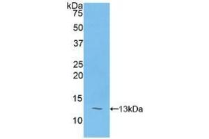 Western Blotting (WB) image for Polymeric Immunoglobulin Receptor (PIGR) ELISA Kit (ABIN6720493)