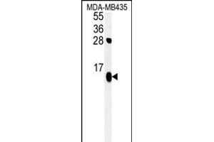 ATP5D Antibody (N-term) (ABIN652148 and ABIN2840566) western blot analysis in MDA-M cell line lysates (35 μg/lane). (ATP5F1D 抗体  (N-Term))