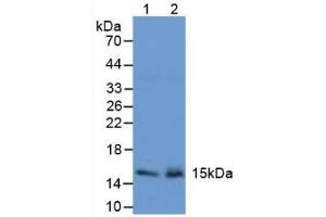 Western blot analysis of (1) Mouse Stomach Tissue and (2) Mouse Pancreas Tissue. (Trefoil Factor 2 抗体  (AA 25-127))