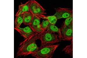 Immunocytochemistry (ICC) image for anti-Chromobox Homolog 1 (CBX1) (AA 1-185) antibody (ABIN5890956) (CBX1 抗体  (AA 1-185))