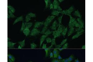 Immunofluorescence analysis of C6 cells using DDX3Y Polyclonal Antibody at dilution of 1:100 (40x lens). (DDX3Y 抗体)
