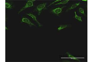 Immunofluorescence (IF) image for anti-Dihydrolipoamide S-Succinyltransferase (E2 Component of 2-Oxo-Glutarate Complex) (DLST) (AA 1-453) antibody (ABIN947795)