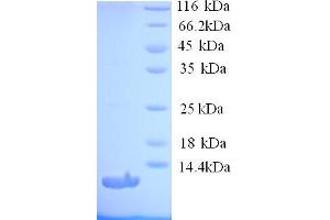 SDS-PAGE (SDS) image for Angiotensin II Receptor, Type 1 (AGTR1) (AA 297-359), (Cytoplasmic Domain), (Cytosolic) protein (His tag) (ABIN5713202)