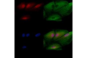 ABIN6260274 and ABIN6272782 staining  cells by IF/ICC.
