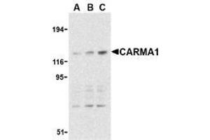 Western blot analysis of CARMA1 expression in mouse thymus cell lysate with AP30186PU-N CARMA1 antibody at 0. (CARD11 抗体)