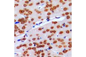 Immunohistochemical analysis of GPRIN2 staining in human brain formalin fixed paraffin embedded tissue section. (GPRIN2 抗体  (N-Term))