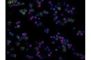 Immunofluorescence (IF) image for anti-CD3 (CD3) antibody (Alexa Fluor 594) (ABIN2656823) (CD3 抗体  (Alexa Fluor 594))