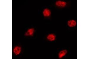 ABIN6275323 staining MCF7 by IF/ICC. (NXF3 抗体  (N-Term))