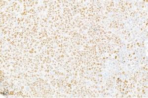 Immunohistochemistry (IHC) image for anti-Matrin 3 (MATR3) (C-Term) antibody (ABIN7455225)