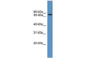 WB Suggested Anti-BBS2 Antibody Titration: 1. (BBS2 抗体  (N-Term))