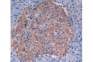 IHC-P analysis of Human Tissue, with DAB staining. (PVRL4 抗体  (AA 31-317))