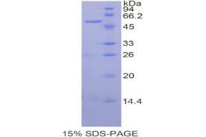 SDS-PAGE analysis of Human SIAE Protein. (SIAE 蛋白)