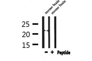Western blot analysis of extracts from mouse brain, using FGF20 Antibody. (FGF20 抗体  (Internal Region))