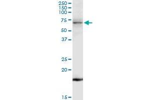 TNK2 MaxPab rabbit polyclonal antibody. (TNK2 抗体  (AA 1-352))