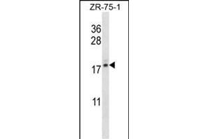 TNP2 Antibody (C-term) (ABIN656736 and ABIN2845960) western blot analysis in ZR-75-1 cell line lysates (35 μg/lane).