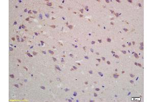 Formalin-fixed and paraffin embedded rat brain labeled with Rabbit Anti ADORA1 Polyclonal Antibody, Unconjugated (ABIN705656) at 1:200 followed by conjugation to the secondary antibody and DAB staining (ADORA1 抗体  (AA 151-250))