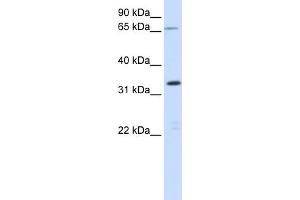 WB Suggested Anti-C19orf47 Antibody Titration:  0. (C19orf47 抗体  (Middle Region))