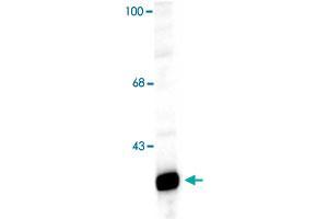 Western blot of a rat hippocampal lysate showing specific immunolabeling of the ~32k Ppp1r1b protein. (DARPP32 抗体  (N-Term))