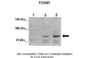 Lanes:   Lane 1: 25ug MIA PaCa-2 human pancreatic cancer cell line)   Lane 2: 25ug MDA-MB-231 cell lysate Lane 3: 25ug Huh-7 cell lysate  Primary Antibody Dilution:   1:2000  Secondary Antibody:   Anti-rabbit-HRP  Secondary Antibody Dilution:   1:5000  Gene Name:   FOXM1  Submitted by:   Andrei L. (FOXM1 抗体  (Middle Region))