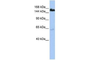 WB Suggested Anti-TNKS Antibody Titration:  1 ug/ml  Positive Control:  HepG2 cell lysate (TNKS 抗体  (Middle Region))