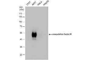 WB Image Tissue factor antibody detects Tissue factor protein by western blot analysis. (Tissue factor 抗体)