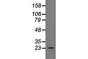 Western blot analysis of 35 µg of cell extracts from human Liver carcinoma (HepG2) cells using anti-TNNI3 antibody. (TNNI3 抗体)