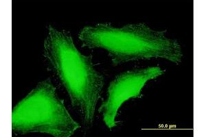 Immunofluorescence (IF) image for anti-TAF8 RNA Polymerase II, TATA Box Binding Protein (TBP)-Associated Factor, 43kDa (TAF8) (AA 1-174) antibody (ABIN530620)