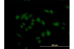 Immunofluorescence of monoclonal antibody to CARF on HeLa cell. (CDKN2AIP 抗体  (AA 1-579))