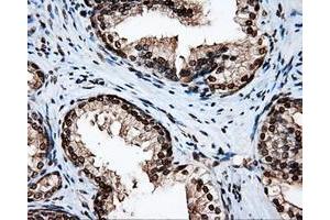 Image no. 3 for anti-Amyloid beta (A4) Precursor Protein (APP) antibody (ABIN1496877) (APP 抗体)