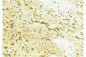 ABIN6276577 at 1/100 staining Mouse muscle tissue by IHC-P. (FAAH 抗体)