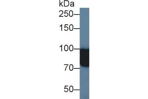 Western Blotting (WB) image for anti-N-Acetylglucosaminidase, alpha (NAGLU) (AA 485-743) antibody (ABIN7435373)