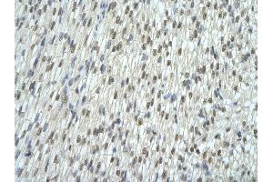 Rabbit Anti-EXOSC7 antibody   Paraffin Embedded Tissue: Human Heart cell Cellular Data: cardiac cell of renal tubule Antibody Concentration: 4. (EXOSC7 抗体  (N-Term))