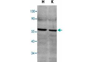 Western blot analysis of TNFRSF10B in HeLa (H) and K-562 (K) cell lysates with TNFRSF10B polyclonal antibody  at 2 ug/mL . (TNFRSF10B 抗体  (C-Term))