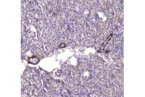 IHC testing of FFPE mouse kidney tissue with CKB antibody at 1ug/ml. (CKB 抗体)