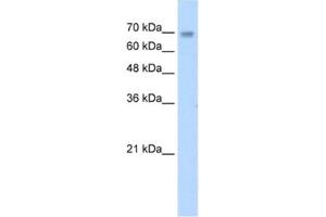 Western Blotting (WB) image for anti-Zinc Finger Protein 264 (ZNF264) antibody (ABIN2461695) (ZNF264 抗体)