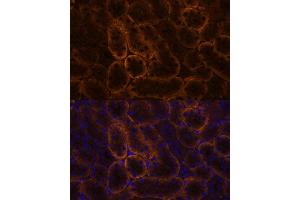 Immunofluorescence (IF) image for anti-Solute Carrier Family 14 (Urea Transporter), Member 1 (Kidd Blood Group) (SLC14A1) (C-Term) antibody (ABIN7270402)