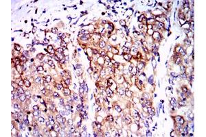 Immunohistochemistry (IHC) image for anti-Protein Phosphatase 2A Activator, Regulatory Subunit 4 (PPP2R4) antibody (ABIN1108715) (PPP2R4 抗体)