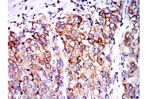 Immunohistochemistry (IHC) image for anti-Protein Phosphatase 2A Activator, Regulatory Subunit 4 (PPP2R4) antibody (ABIN1108715)