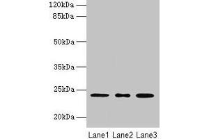 Western blot All lanes: MRPL58 antibody at 2 μg/mL Lane 1: A549 whole cell lysate Lane 2: Jurkat whole cell lysate Lane 3: K562 whole cell lysate Secondary Goat polyclonal to rabbit IgG at 1/10000 dilution Predicted band size: 24 kDa Observed band size: 24 kDa (Peptidyl-tRNA Hydrolase ICT1, Mitochondrial (AA 30-206) 抗体)