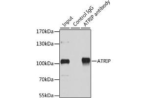 Immunoprecipitation analysis of 200 μg extracts of HeLa cells using 1 μg ATRIP antibody (ABIN1678799, ABIN3019346, ABIN3019347 and ABIN6220835). (ATRIP 抗体  (AA 1-260))