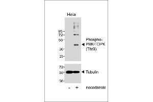 Western blot analysis of lysates from Hela cell line, untreated or treated with Nocodazole, 100 ng/mL, using Phospho-PBK/TOPK (Thr9) Antibody (upper) or Tubulin (lower). (PBK 抗体  (pThr9))
