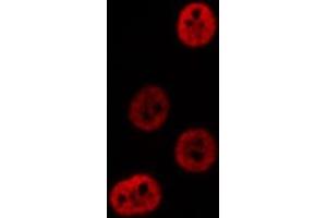 ABIN6276644 staining  NIH-3T3 cells by IF/ICC. (PSMA3 抗体  (Internal Region))