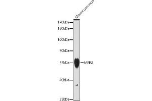 Western blot analysis of extracts of Mouse pancreas, using MEIS1 antibody (ABIN7268449) at 1:1000 dilution. (MEIS1 抗体)
