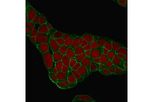 Confocal Immunofluorescence of MCF-7 cells EpCAM Mouse Monoclonal Antibody (EGP40/1384). (EpCAM 抗体  (Extracellular Domain))