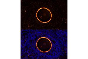 Immunofluorescence analysis of rat oophoroma cells using ZP2 antibody (ABIN6128965, ABIN6150534, ABIN6150535 and ABIN6214263) at dilution of 1:100. (ZP2 抗体  (AA 651-745))