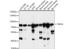 Western blot analysis of extracts of various cell lines, using TBRG4 antibody  at 1:1000 dilution. (TBRG4 抗体  (AA 382-631))