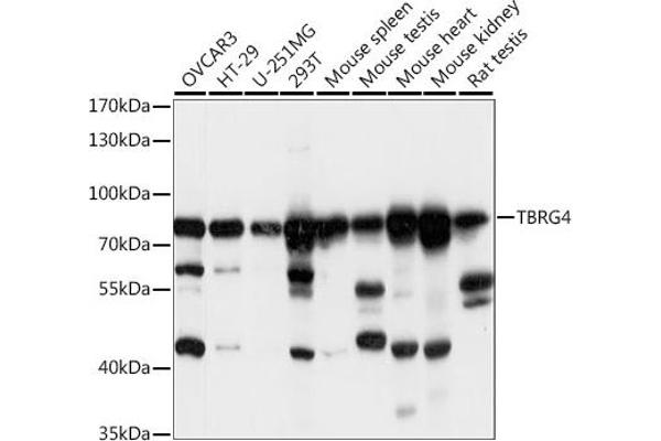 TBRG4 anticorps  (AA 382-631)