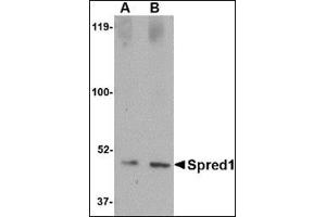 Western blot analysis of Spred1 in human brain tissue lysate with this product at (A) 1 and (B) 2 μg/ml. (SPRED1 抗体  (Center))